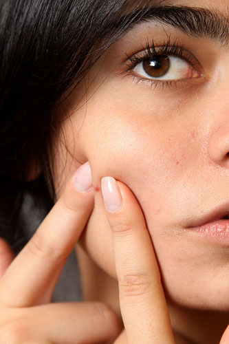 pimple pimple Guest Post: Is Your Makeup Causing Acne?